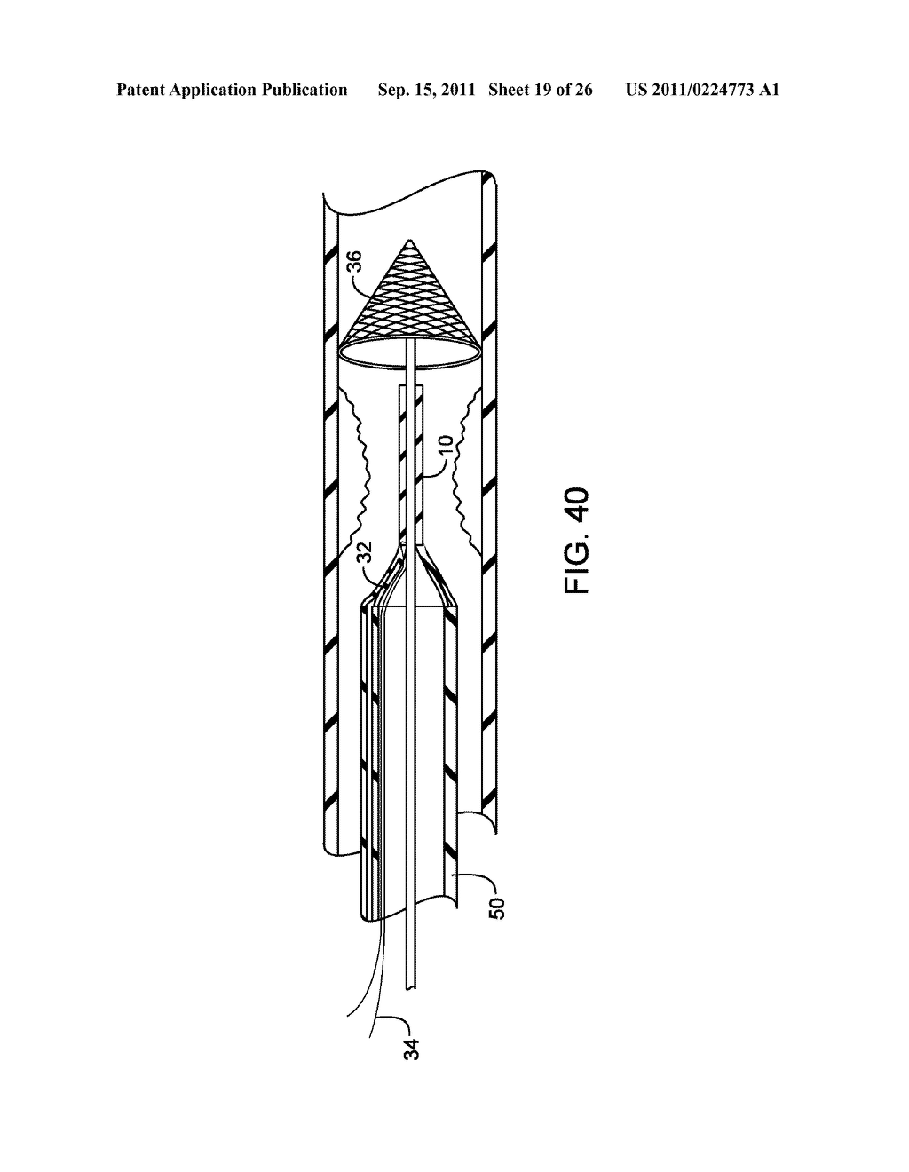 METHODS AND DEVICES FOR PROTECTING A PASSAGEWAY IN A BODY WHEN ADVANCING     DEVICES THROUGH THE PASSAGEWAY - diagram, schematic, and image 20