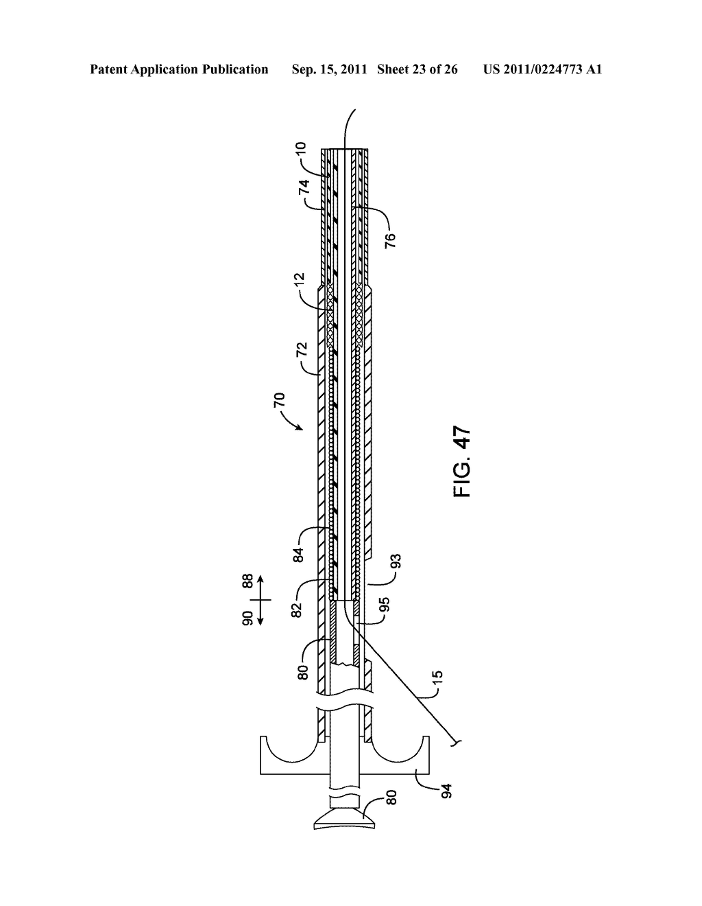 METHODS AND DEVICES FOR PROTECTING A PASSAGEWAY IN A BODY WHEN ADVANCING     DEVICES THROUGH THE PASSAGEWAY - diagram, schematic, and image 24