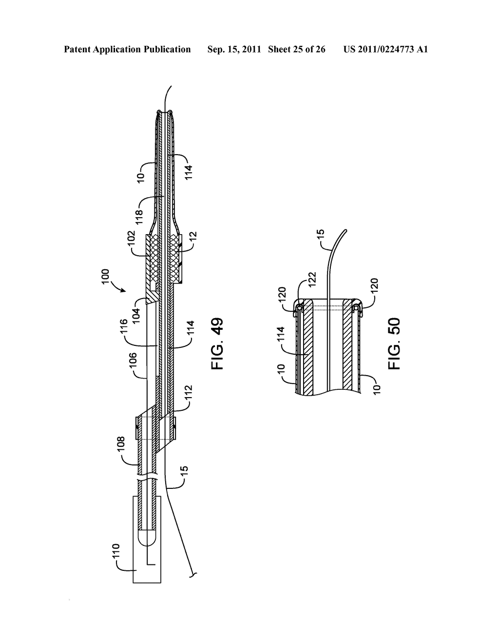 METHODS AND DEVICES FOR PROTECTING A PASSAGEWAY IN A BODY WHEN ADVANCING     DEVICES THROUGH THE PASSAGEWAY - diagram, schematic, and image 26