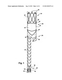 ENDOPROSTHESIS AND DELIVERY SYSTEM FOR DELIVERING THE ENDOPROSTHESIS     WITHIN A VESSEL OF A PATIENT diagram and image