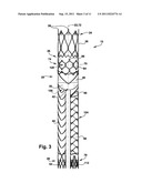 ENDOPROSTHESIS AND DELIVERY SYSTEM FOR DELIVERING THE ENDOPROSTHESIS     WITHIN A VESSEL OF A PATIENT diagram and image