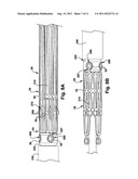 ENDOPROSTHESIS AND DELIVERY SYSTEM FOR DELIVERING THE ENDOPROSTHESIS     WITHIN A VESSEL OF A PATIENT diagram and image