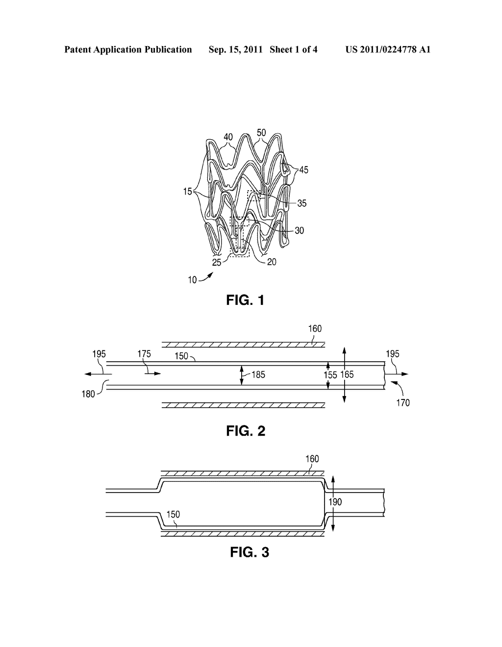 STENT PATTERN FOR POLYMERIC STENTS - diagram, schematic, and image 02