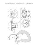 PROSTHETIC MITRAL VALVE WITH TISSUE ANCHORS diagram and image