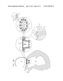 PROSTHETIC MITRAL VALVE WITH TISSUE ANCHORS diagram and image