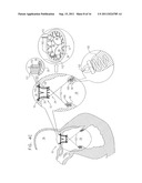 PROSTHETIC MITRAL VALVE WITH TISSUE ANCHORS diagram and image