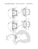 PROSTHETIC MITRAL VALVE WITH TISSUE ANCHORS diagram and image