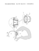 PROSTHETIC MITRAL VALVE WITH TISSUE ANCHORS diagram and image