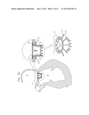 PROSTHETIC MITRAL VALVE WITH TISSUE ANCHORS diagram and image