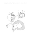 PROSTHETIC MITRAL VALVE WITH TISSUE ANCHORS diagram and image