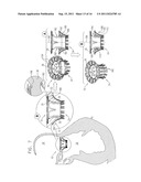 PROSTHETIC MITRAL VALVE WITH TISSUE ANCHORS diagram and image