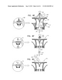 PROSTHETIC MITRAL VALVE WITH TISSUE ANCHORS diagram and image