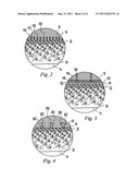 Orthopedic implant with bone interface anchoring diagram and image