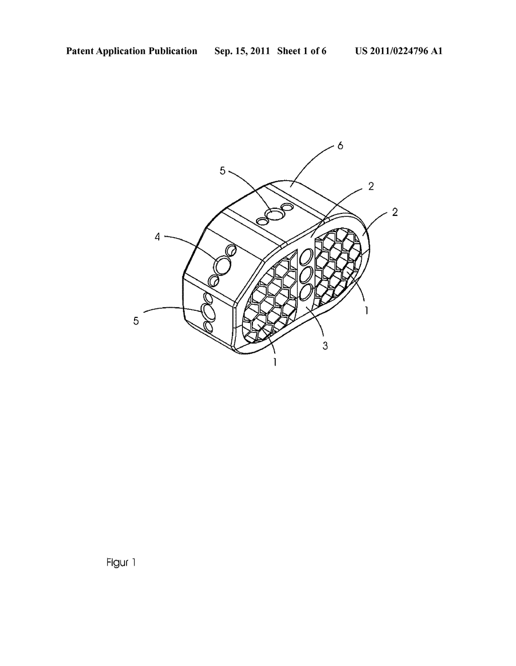 IMPLANT FOR FUSING SPINAL COLUMN SEGMENTS - diagram, schematic, and image 02