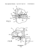 LOW FRICTION SEED METER diagram and image