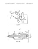 DEPLOYMENT ACTUATION SYSTEM FOR INTRAFALLOPIAN CONTRACEPTION diagram and image