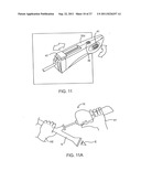 DEPLOYMENT ACTUATION SYSTEM FOR INTRAFALLOPIAN CONTRACEPTION diagram and image