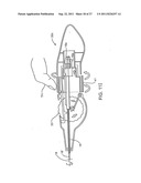 DEPLOYMENT ACTUATION SYSTEM FOR INTRAFALLOPIAN CONTRACEPTION diagram and image