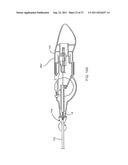 DEPLOYMENT ACTUATION SYSTEM FOR INTRAFALLOPIAN CONTRACEPTION diagram and image