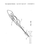 DEPLOYMENT ACTUATION SYSTEM FOR INTRAFALLOPIAN CONTRACEPTION diagram and image