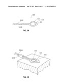 SYSTEMS AND METHODS FOR TREATMENT OF SLEEP APNEA diagram and image