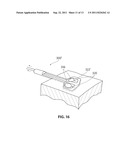 SYSTEMS AND METHODS FOR TREATMENT OF SLEEP APNEA diagram and image