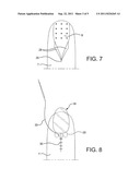 CREATION AND IMPLANTATION OF AN ARTIFICIAL NAIL FOR THE TREATMENT OF     DEFORMED OR MISSING NAILS diagram and image