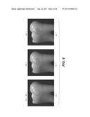 METHOD AND APPARATUS FOR DETECTION OF CARIES diagram and image