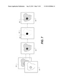 METHOD AND APPARATUS FOR DETECTION OF CARIES diagram and image