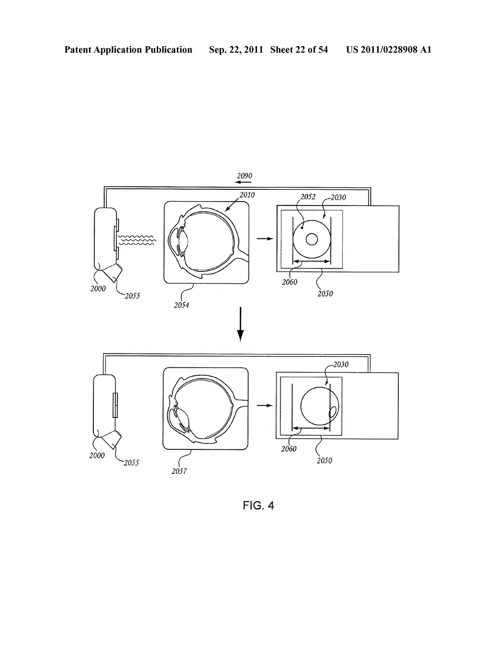 ORTHOVOLTAGE RADIOSURGERY - diagram, schematic, and image 23