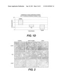 TARGETING PAX2 FOR THE TREATMENT OF BREAST CANCER diagram and image