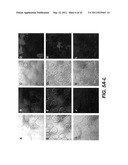 TARGETING PAX2 FOR THE TREATMENT OF BREAST CANCER diagram and image