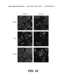 TARGETING PAX2 FOR THE TREATMENT OF BREAST CANCER diagram and image