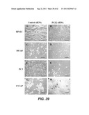 TARGETING PAX2 FOR THE TREATMENT OF BREAST CANCER diagram and image