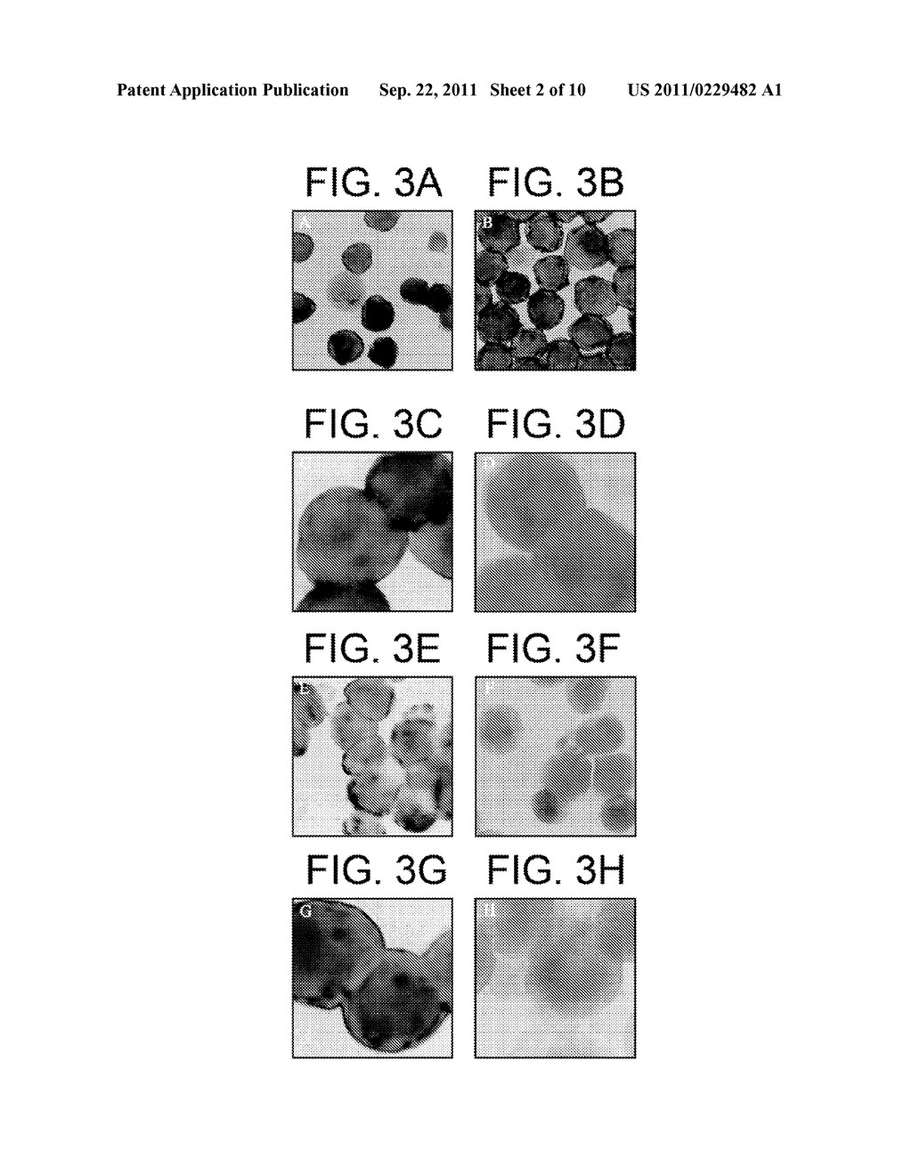 Method of inhibiting infection by HCV, other flaviviridae viruses, and any     other virus that complexes to low density lipoprotein or to very low     density lipoprotein in blood by preventing viral entry into a cell - diagram, schematic, and image 03