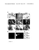 TUMOR ANGIOGENESIS ASSOCIATED GENES AND A METHOD FOR THEIR IDENTIFICATION diagram and image