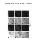 COMPOSITIONS AND METHODS FOR DIAGNOSING, TREATING, AND PREVENTING PROSTATE     CONDITIONS diagram and image