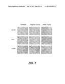 COMPOSITIONS AND METHODS FOR DIAGNOSING, TREATING, AND PREVENTING PROSTATE     CONDITIONS diagram and image