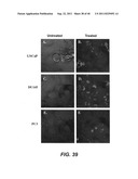 COMPOSITIONS AND METHODS FOR DIAGNOSING, TREATING, AND PREVENTING PROSTATE     CONDITIONS diagram and image