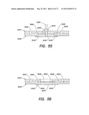 METHODS AND APPARATUS FOR MEASURING ANALYTES USING LARGE SCALE FET ARRAYS diagram and image