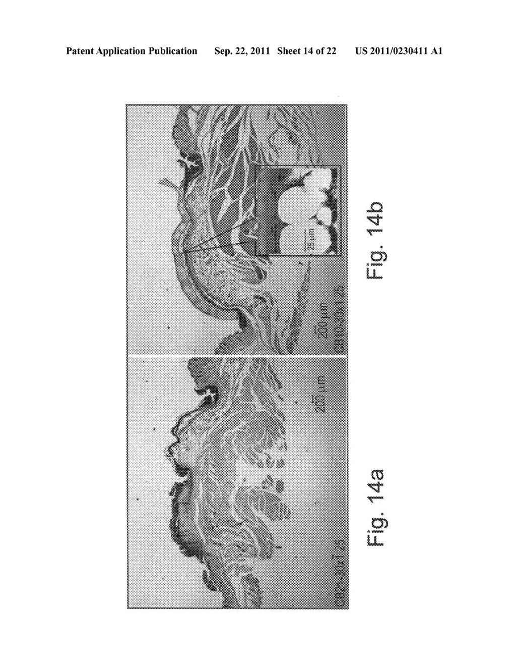 Albumin fibers and fabrics and methods of generating and using same - diagram, schematic, and image 15