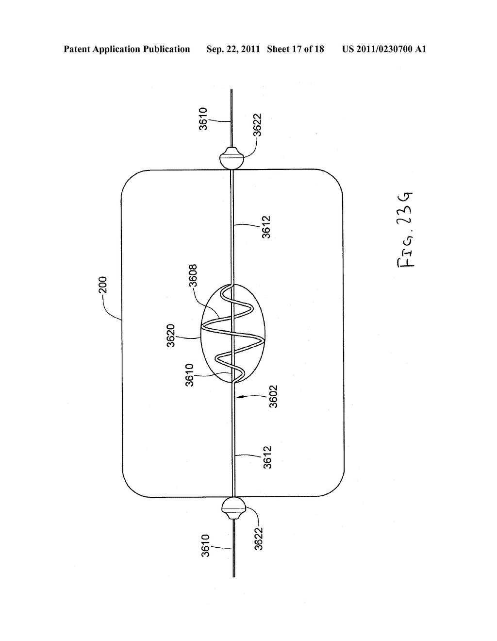 EXPANDABLE BRACHYTHERAPY APPARATUS AND METHODS FOR USING THEM - diagram, schematic, and image 18