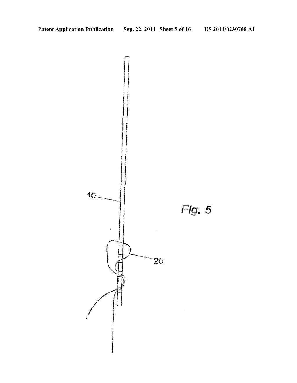 ADJUSTABLE SURGICAL IMPLANT FOR PELVIC ANATOMY - diagram, schematic, and image 06