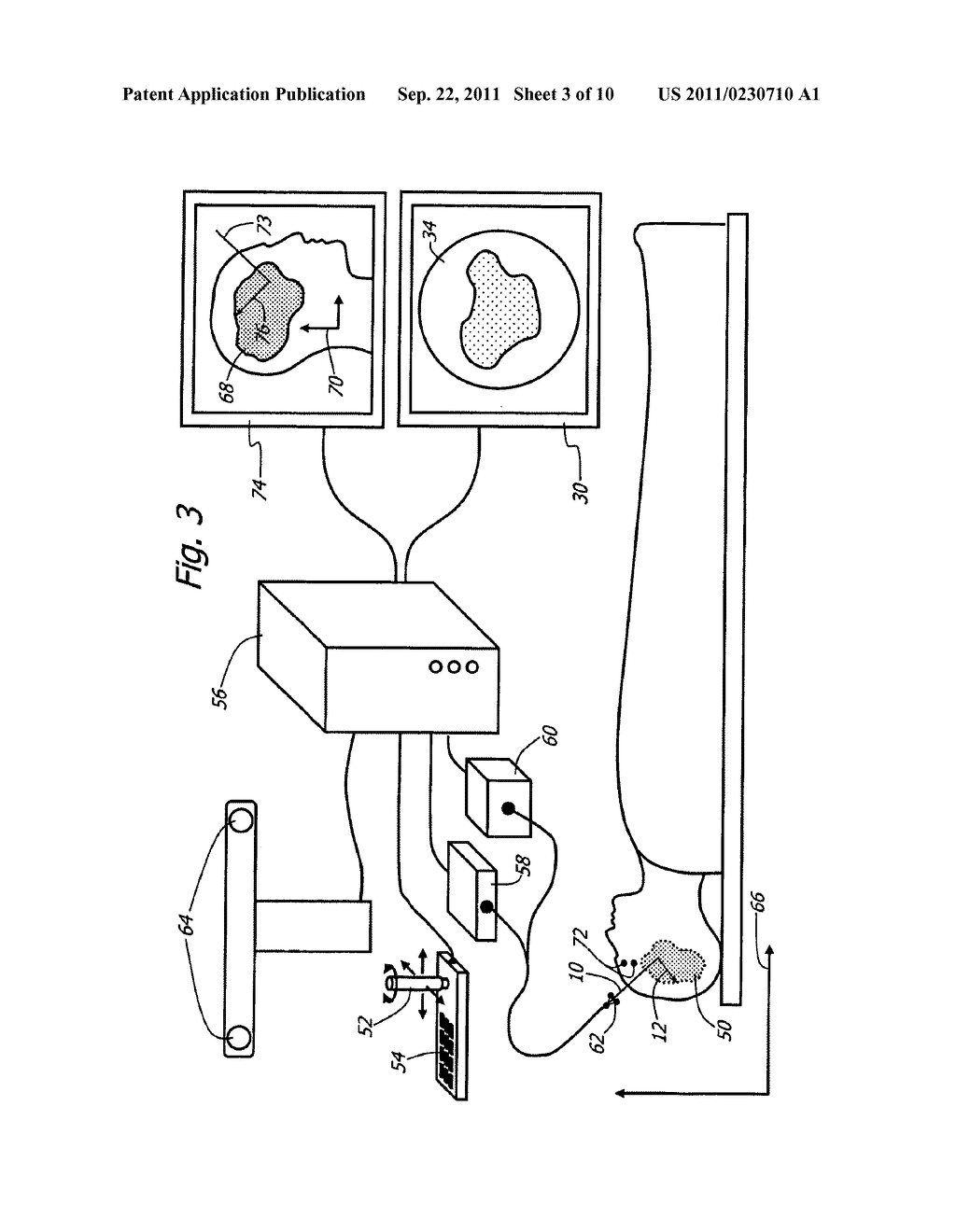 Method For Using Variable Direction Of View Endoscopy In Conjunction With     Image Guided Surgical Systems - diagram, schematic, and image 04