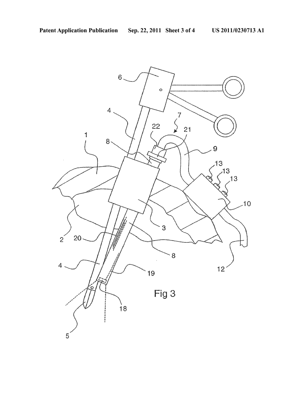 LAPAROSCOPE WITH ADJUSTABLE SHAFT - diagram, schematic, and image 04