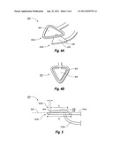 SURGICAL INSTRUMENT diagram and image