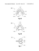 SURGICAL INSTRUMENT diagram and image