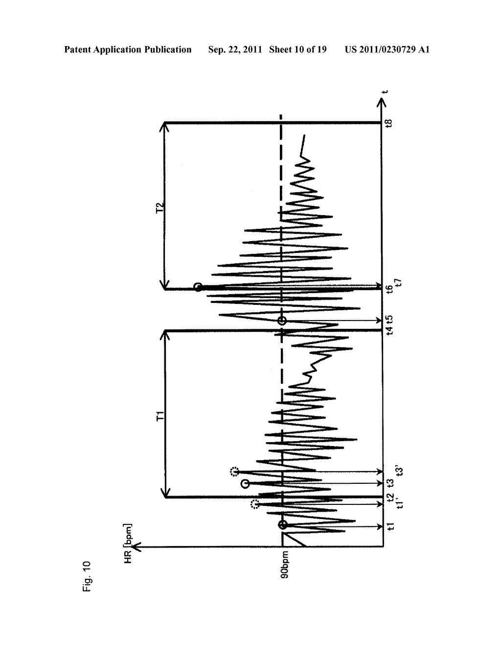 BLOOD PRESSURE MEASUREMENT DEVICE FOR MEASURING AT APPROPRIATE TIMING - diagram, schematic, and image 11