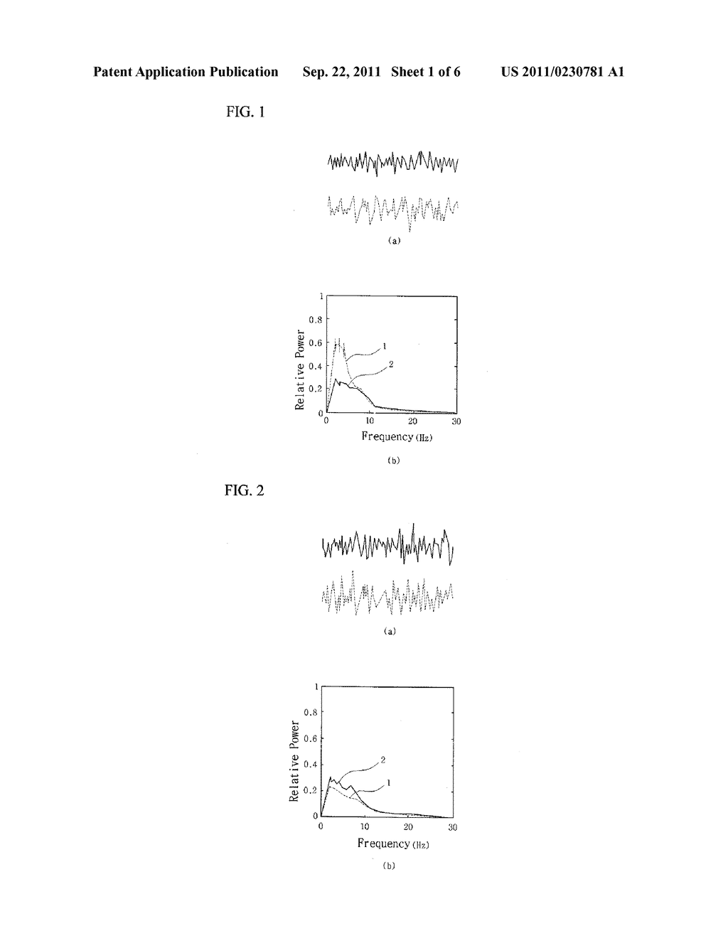 APPARATUS AND METHOD FOR DEMENTIA DIAGNOSIS THROUGH EEG     (ELECTROENCEPHALOGRAM) ANALYSIS - diagram, schematic, and image 02