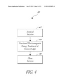 METHODS OF LIGHT TREATMENT OF WOUNDS TO REDUCE SCAR FORMATION diagram and image